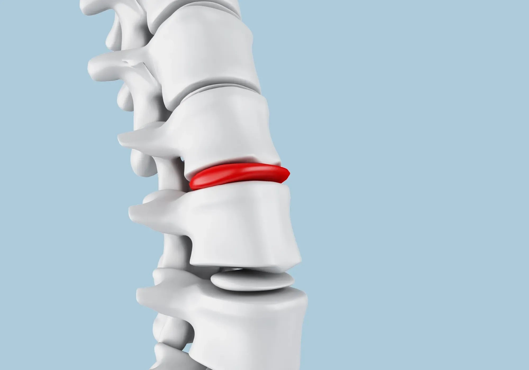 9 начина за облекчаване на болки при дискова херния
