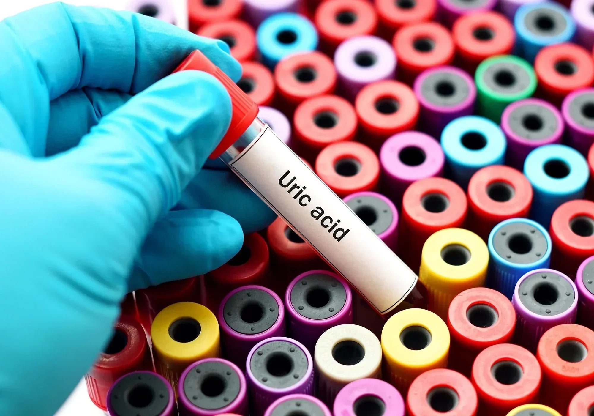 Каква е връзката между магнезия и пикочната киселина?